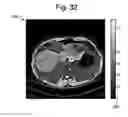Fig. 30 - Dielectric encoding of medical images