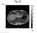 Fig. 31 - Dielectric encoding of medical images