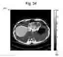 Fig. 32 - Dielectric encoding of medical images