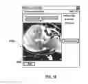 Fig. 17 - Systems and methods for tracking positions between imaging modalities and transforming a displayed three-dimensional image corresponding to a position and orientation of a probe