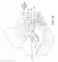 Fig. 06 - Metal liftoff tools and methods