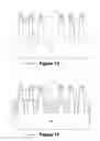 Fig. 04 - Methods of removing portions of fins by preforming a selectively etchable material in the substrate