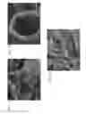 Fig. 06 - Hollow silicon structures for use as anode active materials in lithium-ion batteries