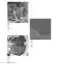 Fig. 08 - Hollow silicon structures for use as anode active materials in lithium-ion batteries
