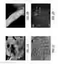 Fig. 03 - Polycrystalline vanadium oxide nanosheets