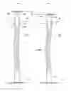 Fig. 01 - Contact probe