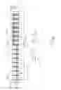Fig. 06 - Light wave communication