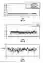 Fig. 06 - Hearing aids with adaptive beamformer responsive to off-axis speech