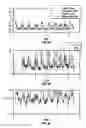 Fig. 08 - Hearing aids with adaptive beamformer responsive to off-axis speech