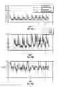 Fig. 09 - Hearing aids with adaptive beamformer responsive to off-axis speech