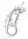 Fig. 01 - Hearing aid and method for producing a hearing aid