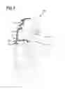 Fig. 04 - Hearing aid and method for producing a hearing aid