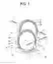 Fig. 02 - Discharge electrodes for use in a light source device