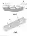 Fig. 02 - MOLLUSK BARRIER