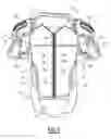 Fig. 02 - PROTECTIVE BODY ARMOR HAVING A FRONT OPENING