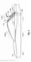 Fig. 06 - Sandal With Adjustable Strap