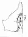 Fig. 07 - BI-LAYER ORTHOTIC