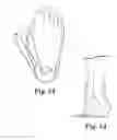 Fig. 35 - BI-LAYER ORTHOTIC