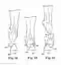Fig. 29 - ORTHOTIC