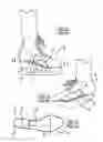Fig. 02 - INSERT FOR ROCKERED FOOT BED OF FOOTWEAR