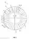 Fig. 06 - Surgical guide and surgical method
