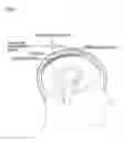 Fig. 02 - BRAIN ELECTRODE SYSTEM