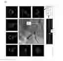Fig. 09 - Co-use of endoluminal data and extraluminal imaging