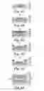 Fig. 10 - Pressure sensing catheter system