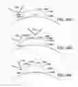 Fig. 35 - APPARATUS FOR PROVIDING DERIVED GLUCOSE INFORMATION UTILIZING NON-INVASIVE PHYSIOLOGICAL SENSORS