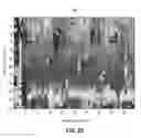 Fig. 06 - Detecting coronary stenosis through spatio-temporal tracking