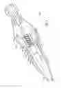 Fig. 06 - Hemostatic device and its methods of use