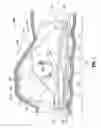 Fig. 02 - Multi-lumen-catheter retractor system for a minimally-invasive, operative gastrointestinal treatment
