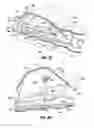 Fig. 07 - Multi-lumen-catheter retractor system for a minimally-invasive, operative gastrointestinal treatment