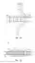 Fig. 03 - Knotless anchor