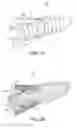 Fig. 04 - Knotless anchor