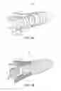 Fig. 06 - Knotless anchor