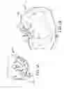 Fig. 02 - Trans-catheter ventricular reconstruction structures, methods, and systems for treatment of congestive heart failure and other conditions