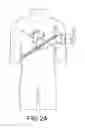 Fig. 03 - Trans-catheter ventricular reconstruction structures, methods, and systems for treatment of congestive heart failure and other conditions