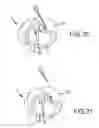 Fig. 33 - Trans-catheter ventricular reconstruction structures, methods, and systems for treatment of congestive heart failure and other conditions