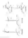 Fig. 34 - Trans-catheter ventricular reconstruction structures, methods, and systems for treatment of congestive heart failure and other conditions