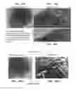 Fig. 45 - Trans-catheter ventricular reconstruction structures, methods, and systems for treatment of congestive heart failure and other conditions