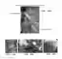Fig. 46 - Trans-catheter ventricular reconstruction structures, methods, and systems for treatment of congestive heart failure and other conditions