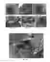 Fig. 48 - Trans-catheter ventricular reconstruction structures, methods, and systems for treatment of congestive heart failure and other conditions