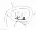 Fig. 02 - SURGICAL DEVICE FOR REPAIRING TISSUE