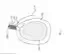 Fig. 05 - SURGICAL DEVICE FOR REPAIRING TISSUE