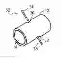 Fig. 01 - Device and method for securing body tissue