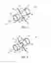Fig. 03 - Device and method for securing body tissue
