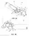 Fig. 04 - Surgical suturing device for a replacement anatomical structure and methods thereof