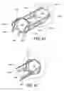 Fig. 16 - Surgical suturing device for a replacement anatomical structure and methods thereof