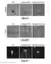 Fig. 08 - NANOFIBROUS CONDUITS FOR NERVE REGENERATION